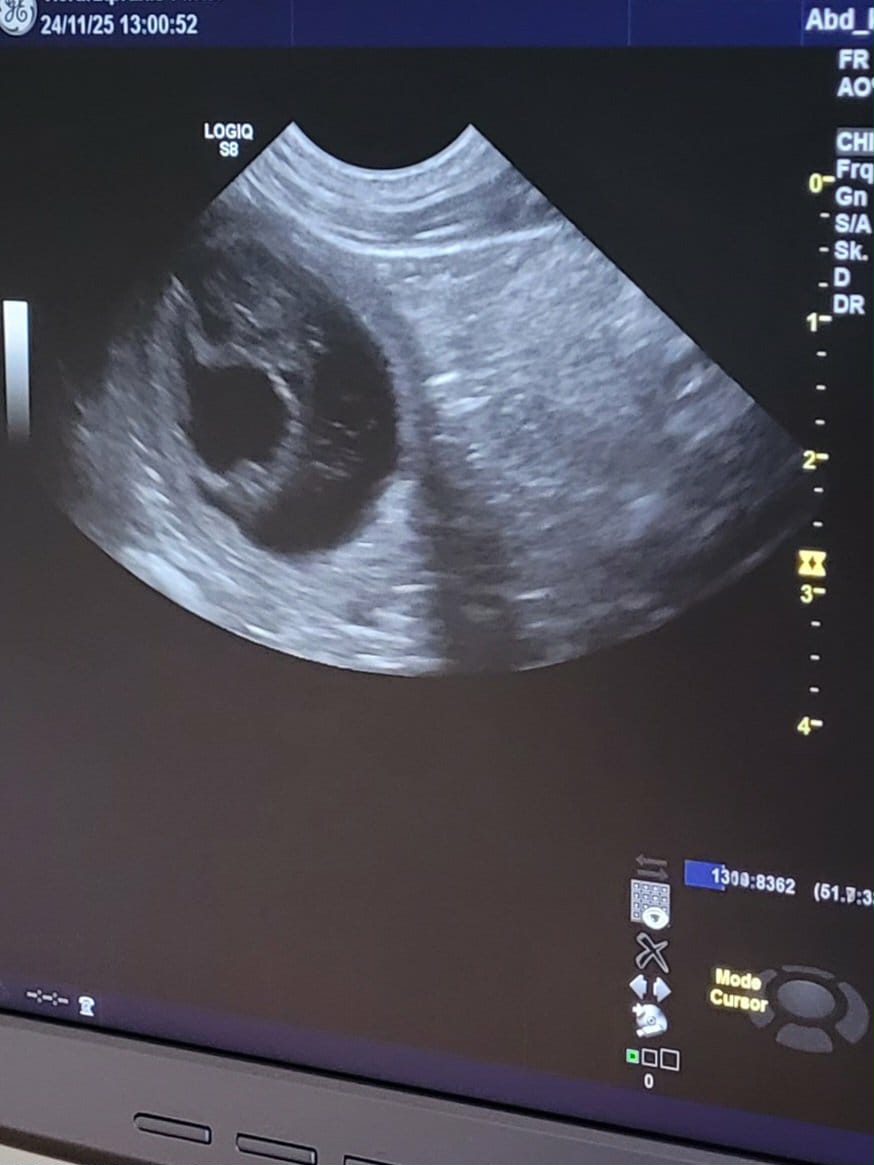 Trächtigkeit bestätigt, F-Wurf ist unterwegs